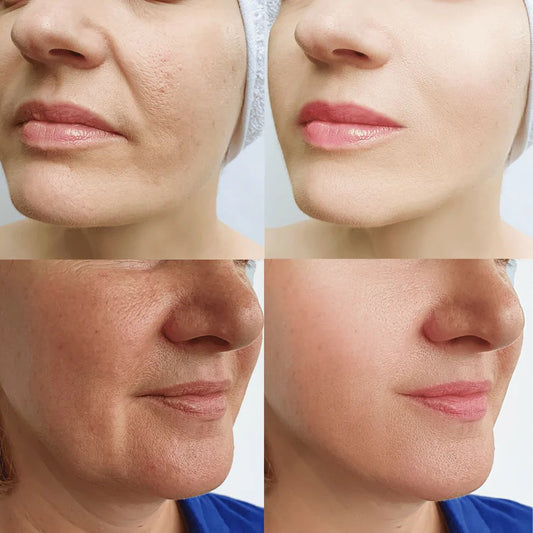 CREMA ANTIENVEJECIMIENTO  + ANTIARRUGAS